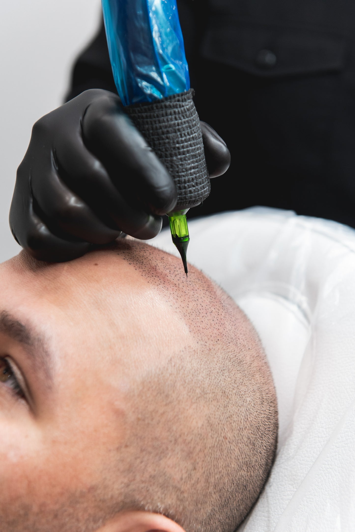 Scalp Micro Pigmentation (SMP)- In Person $1,999 | Deposit $500