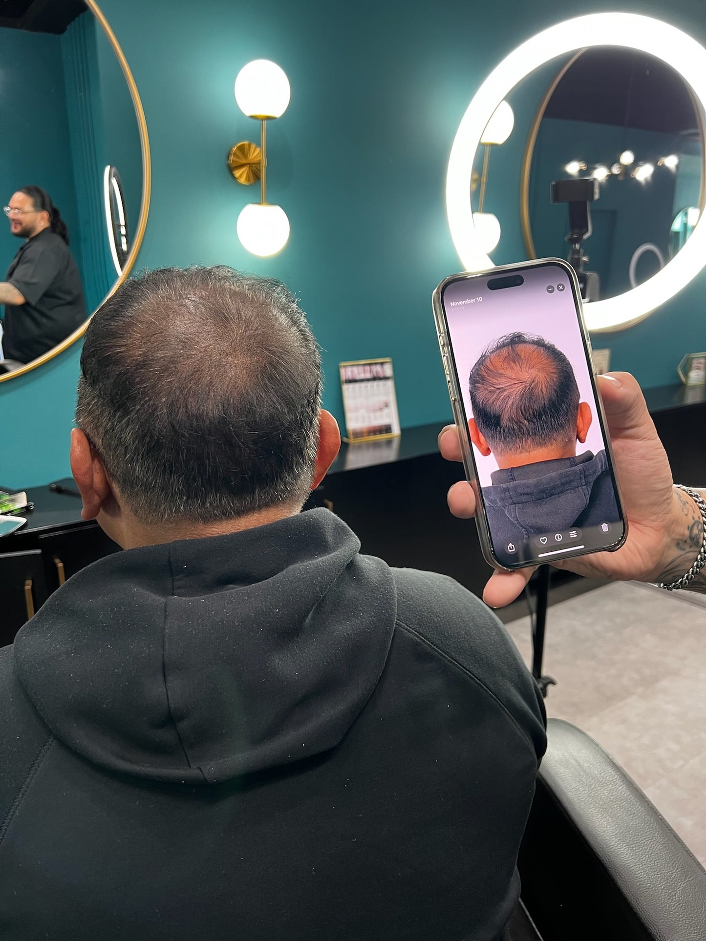 Scalp Micro Pigmentation (SMP)- In Person $1,999 | Deposit $500