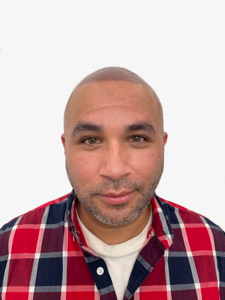 Scalp Micro Pigmentation (SMP)- In Person $1,999 | Deposit $500