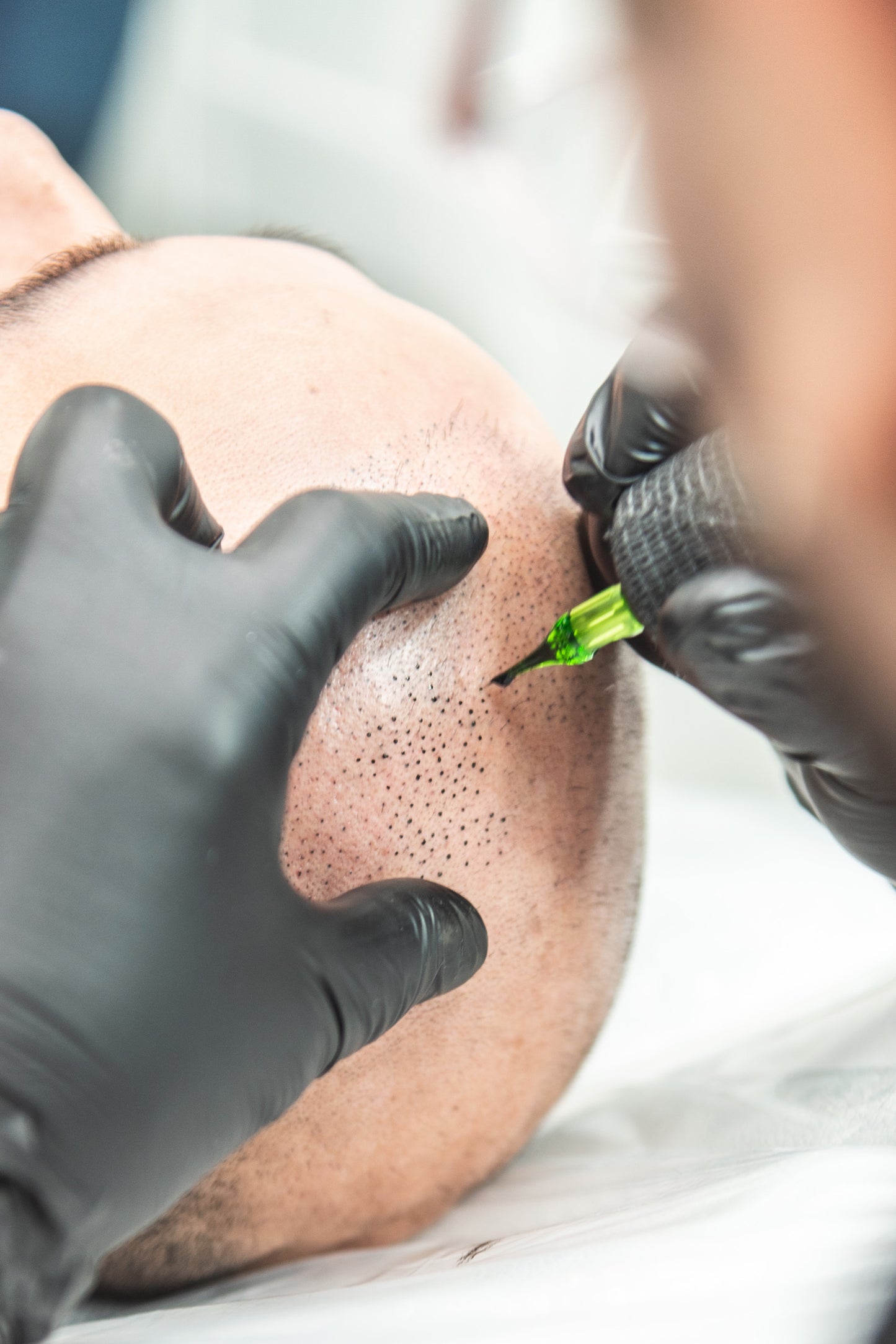 Scalp Micro Pigmentation (SMP)- In Person $1,999 | Deposit $500