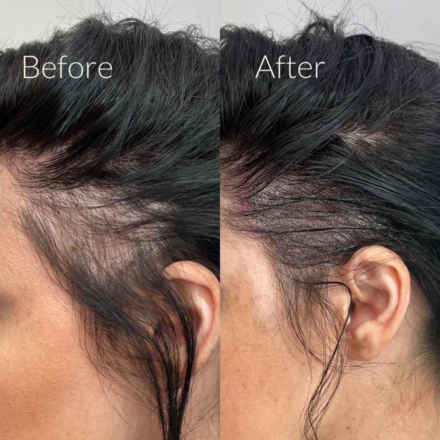 Scalp Micro Pigmentation (SMP)- In Person $1,999 | Deposit $500